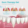 Ceoerty™ Gum Shield Therapy Gel
