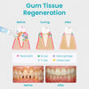 Ceoerty™ Gum Shield Therapy Gel