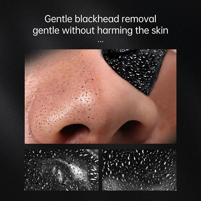 blackhead treatment peeling mask